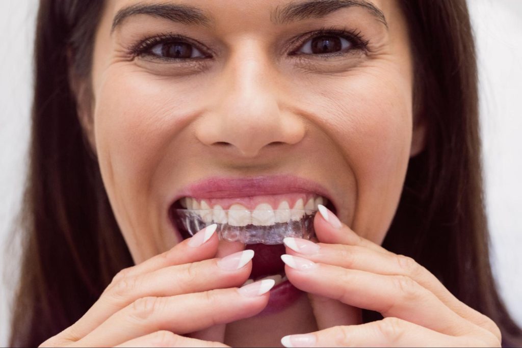How Invisalign Offers a Comfortable and Effective Way to Straighten Teeth