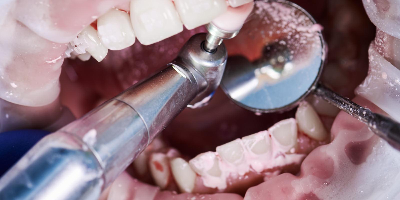 General Dentistry Best Practices for Keeping Your Teeth Healthy