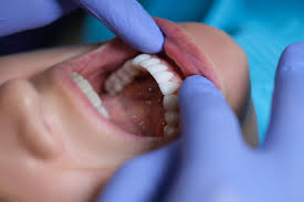 How To Maintain Your Results After Cosmetic Dental Treatments How To Maintain Your Results After Cosmetic Dental Treatments