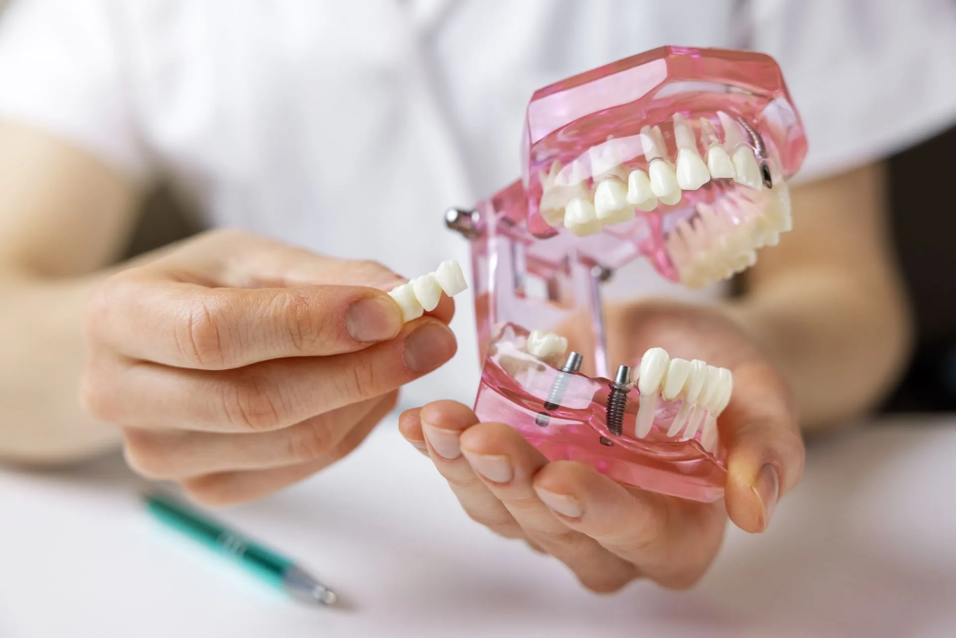 Exploring the Different Services Offered in Cosmetic Dentistry
