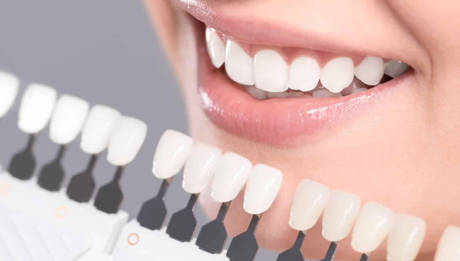 The Technology and Techniques Used in Teeth Whitening