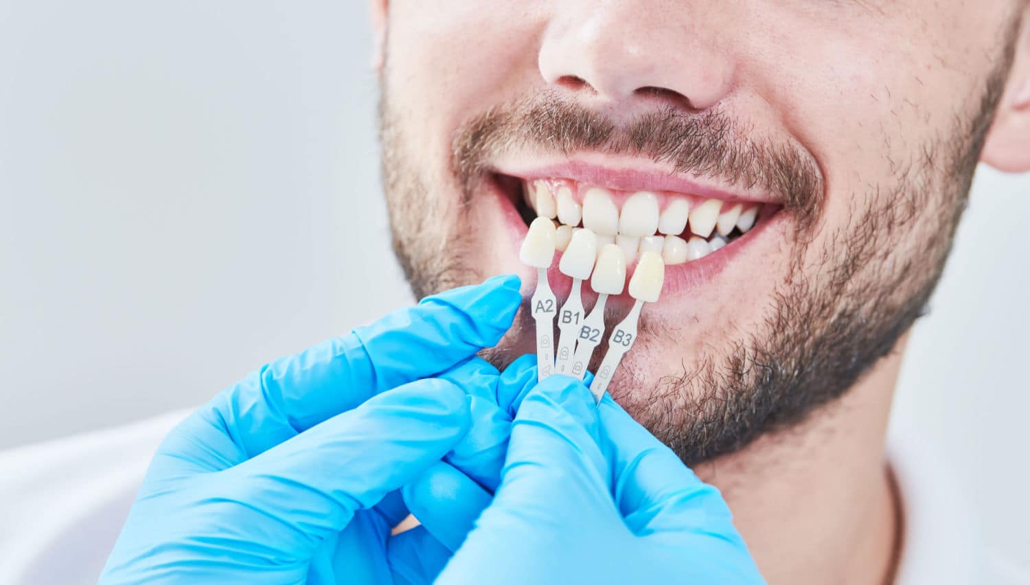 Understanding the Different Types of Dental Restoration Techniques