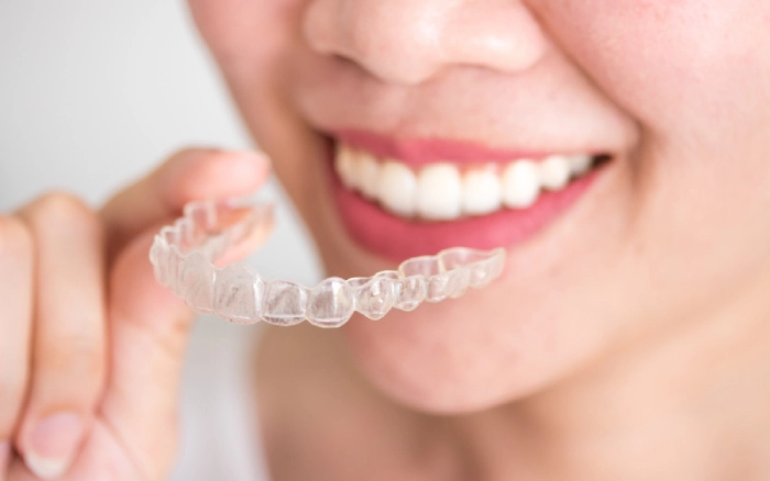 A Step-by-step Guide on How Invisalign Works