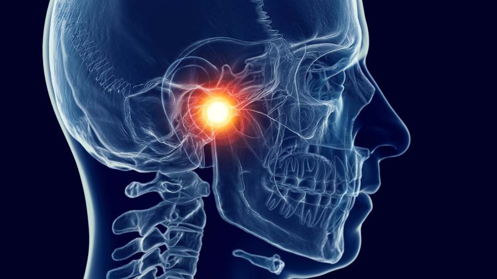 The Role of TMJ in Chronic Pain Conditions