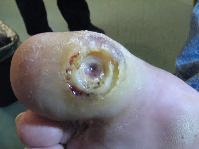 Innovative Products to Enhance Wound Care Practices