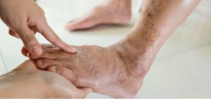 Recognizing the Signs of Leg Pain Due to Circulatory Issues