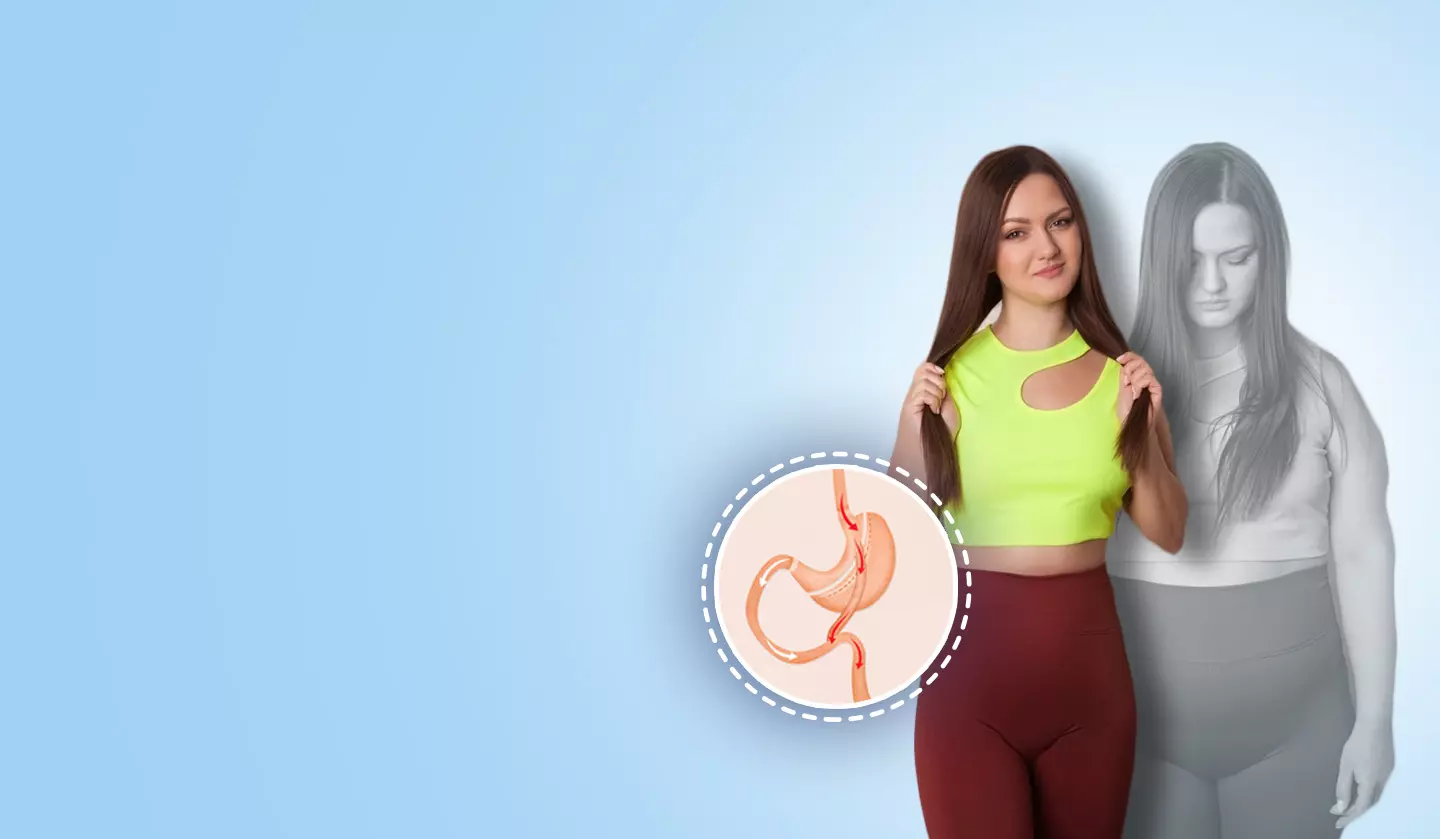 Understanding the Long-Term Outcomes of Bariatric Surgery