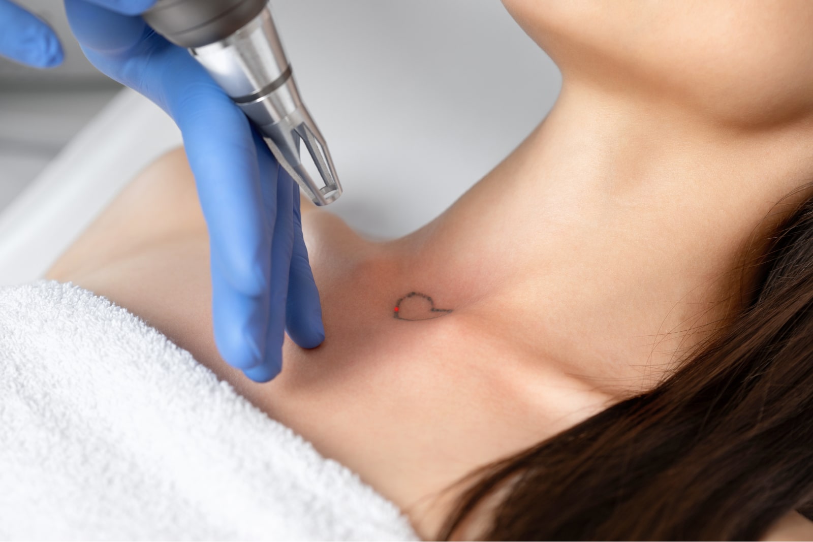 What Can Tattoo Removal Do for Me?